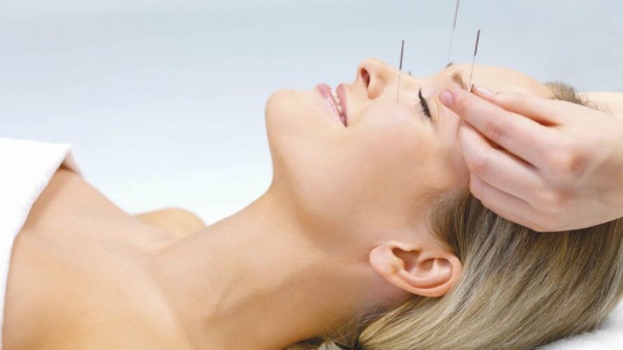 Akupunktura-glava1