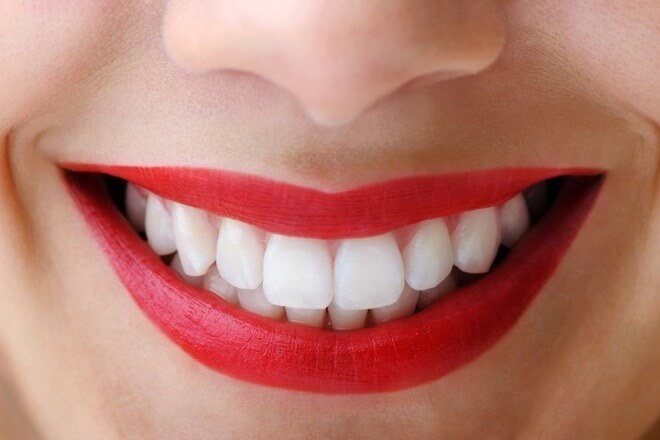 bijeli zubi 