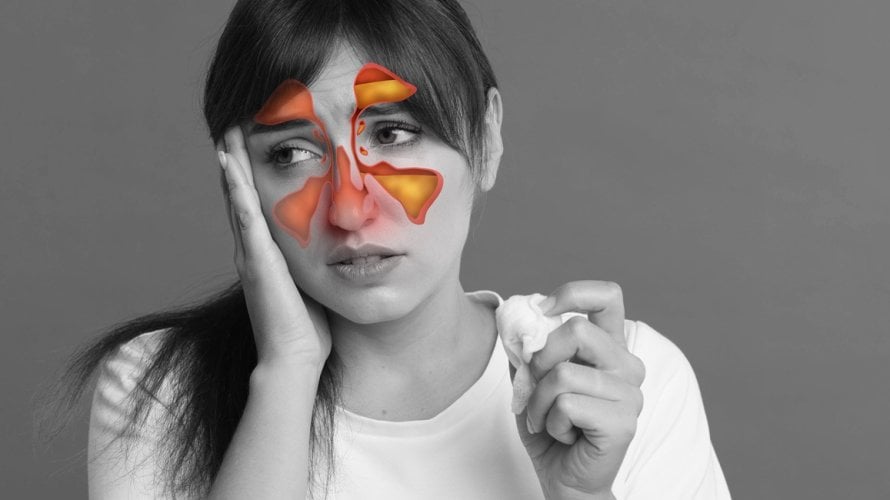 Upala sinusa - simptomi