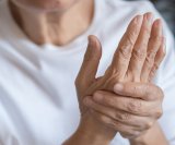 Reumatoidni artritis - simptomi