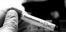 toksoplazmoza - testiranje