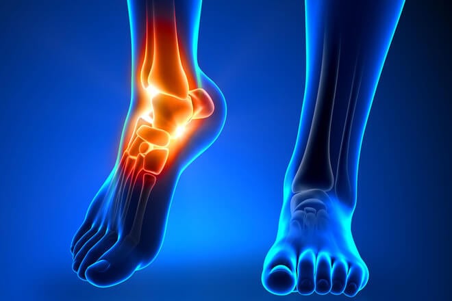 liječenje artroze koljena terapijom udarnim valovima zglobovi i mišići boli