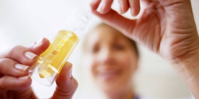 Infekcije - test urina