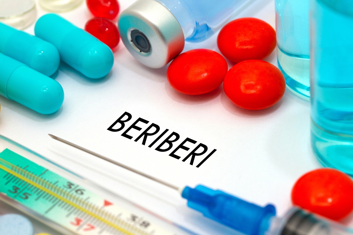 beriberi sindrom