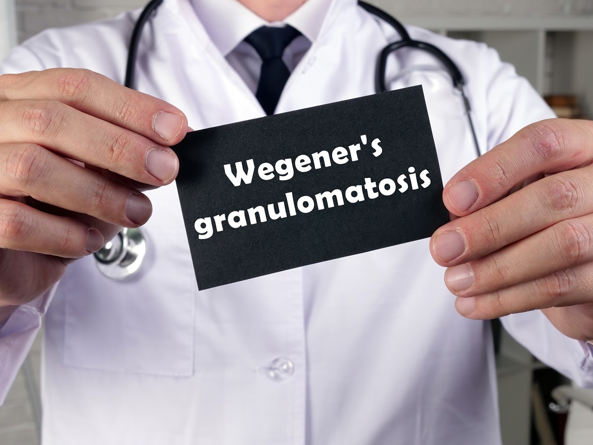 granulomatoza s poliangiitisom