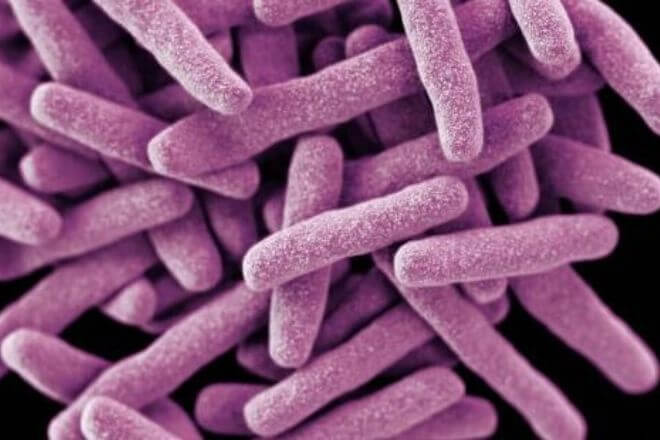 Bakterija - tuberkuloza