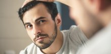Androgenična ili androgenetska alopecija