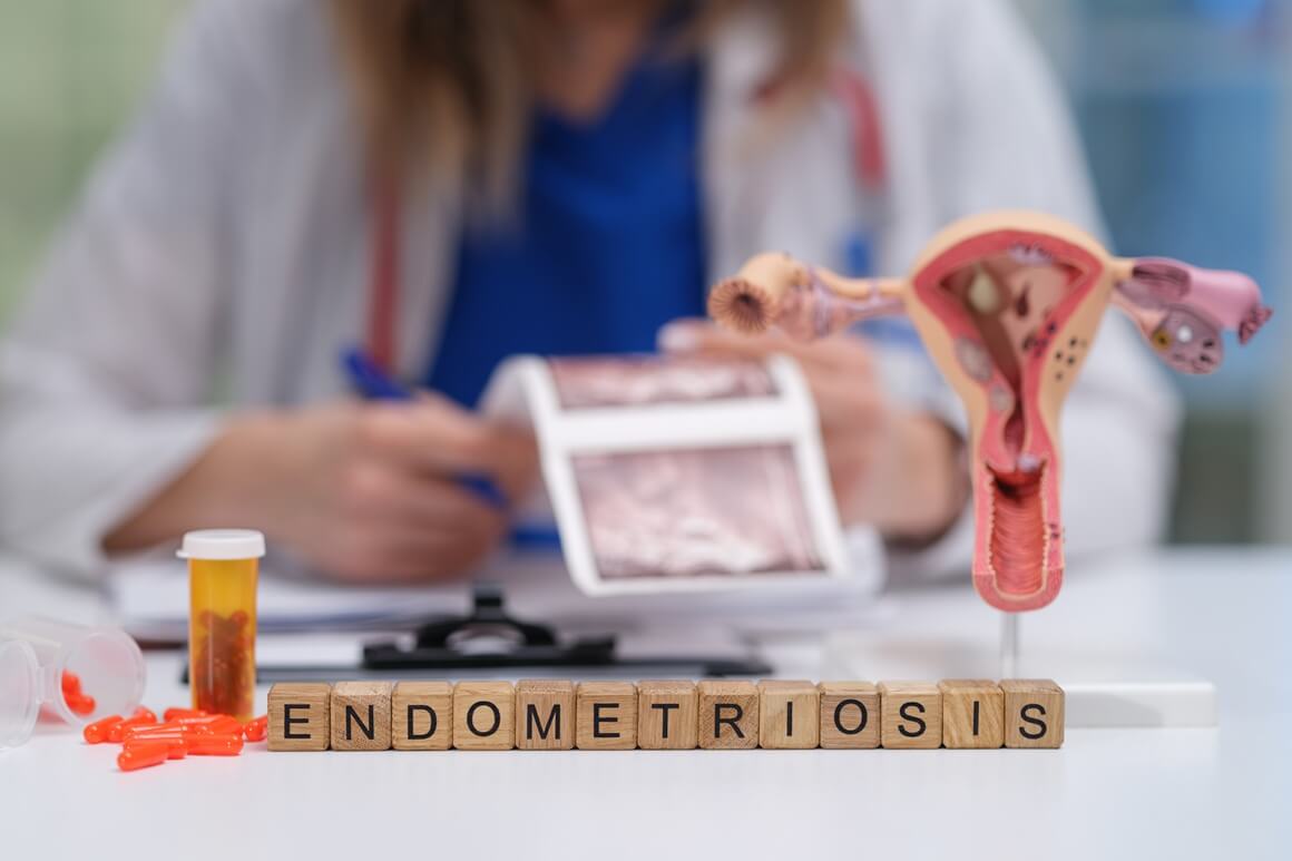 Endometrioza - liječenje