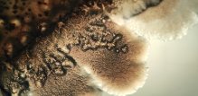 Candida albicans u urinu