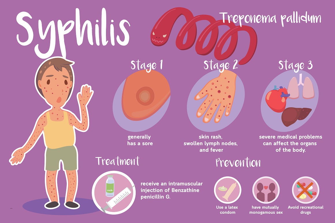Klinička slika sifilisa