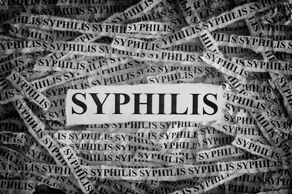 Povijest sifilisa