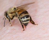 Ubod pčele ili ose