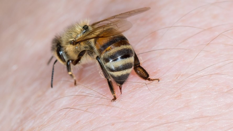 Ubod pčele ili ose