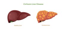 hepatitis B virus