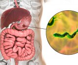 Helicobacter pylori