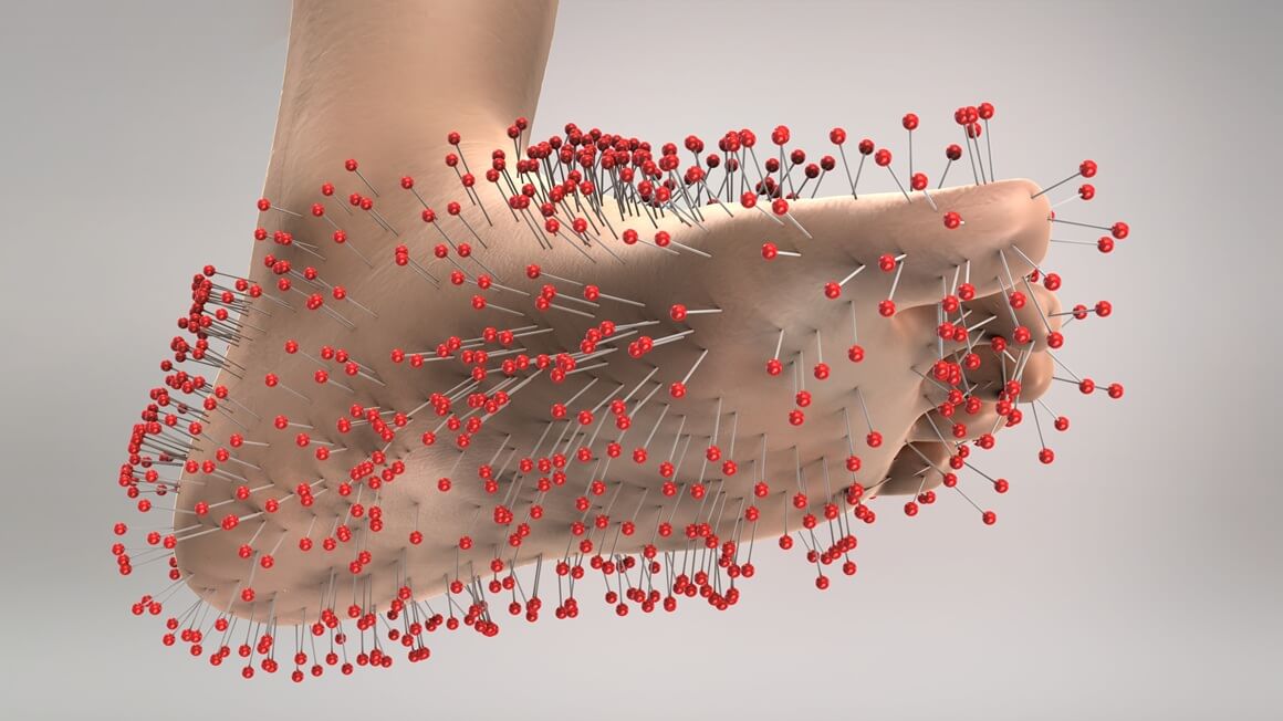 Periferna neuropatija stopala