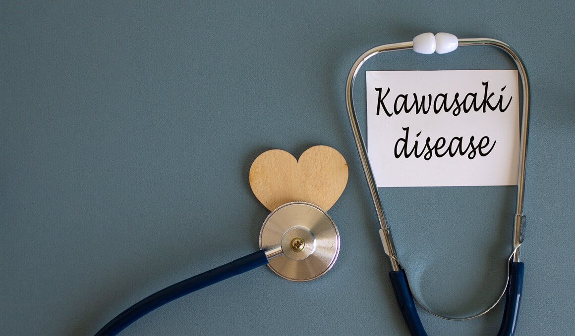Kawasaki bolest - liječenje