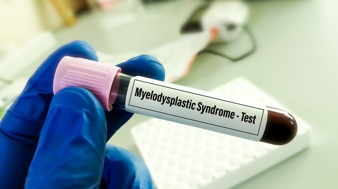 Mijelodisplastični sindrom