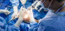 Osteoartritis - operacija