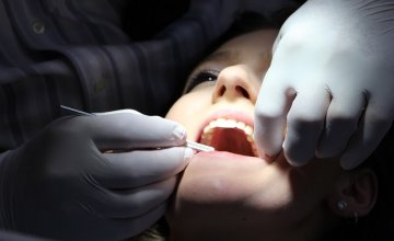 zubni implantati