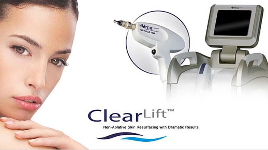 clear lift poliderma