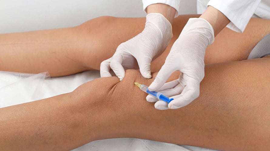 Injekcije u zglob koljena za artrozu: koji lijekovi se koriste za injekciju