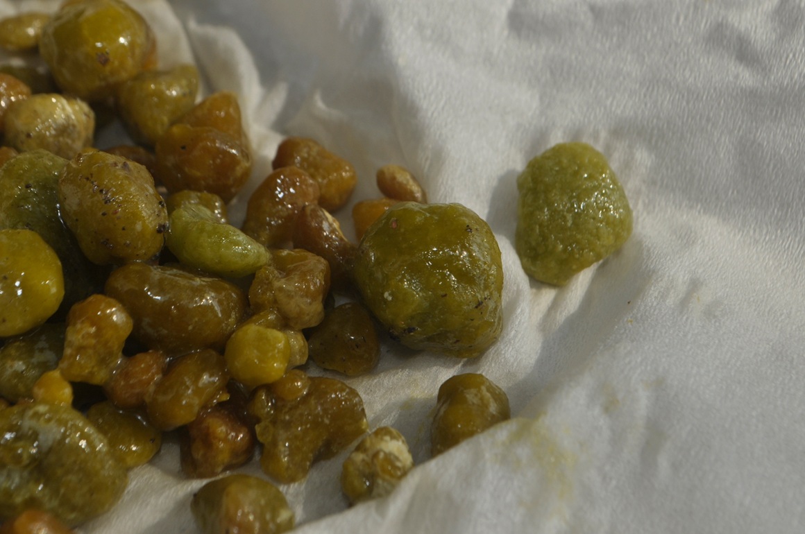 kako se riješiti žučnih kamenaca