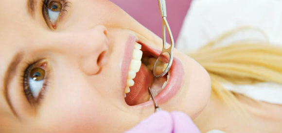 Zubni implantanti