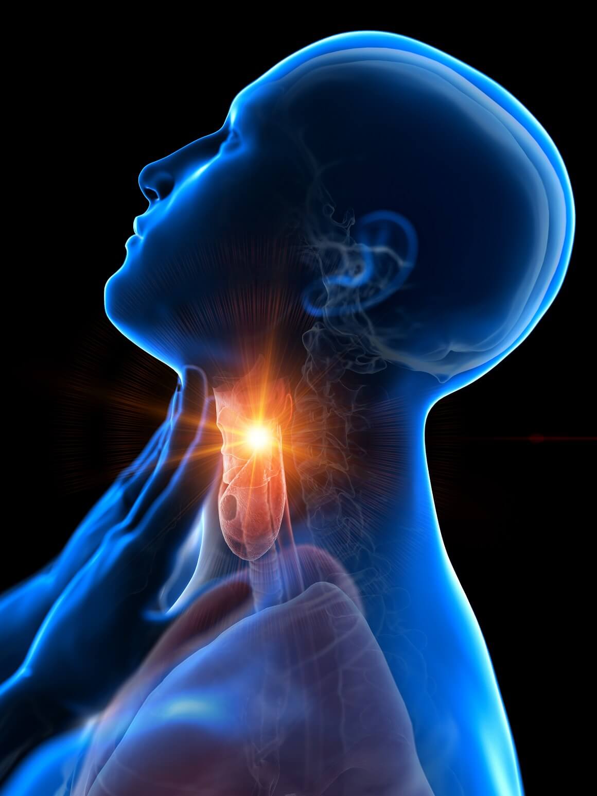 Akutna upala grla (tonzilitis, faringitis) najčešća je streptokokna infekcija