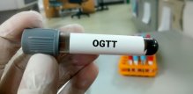 OGTT pretraga