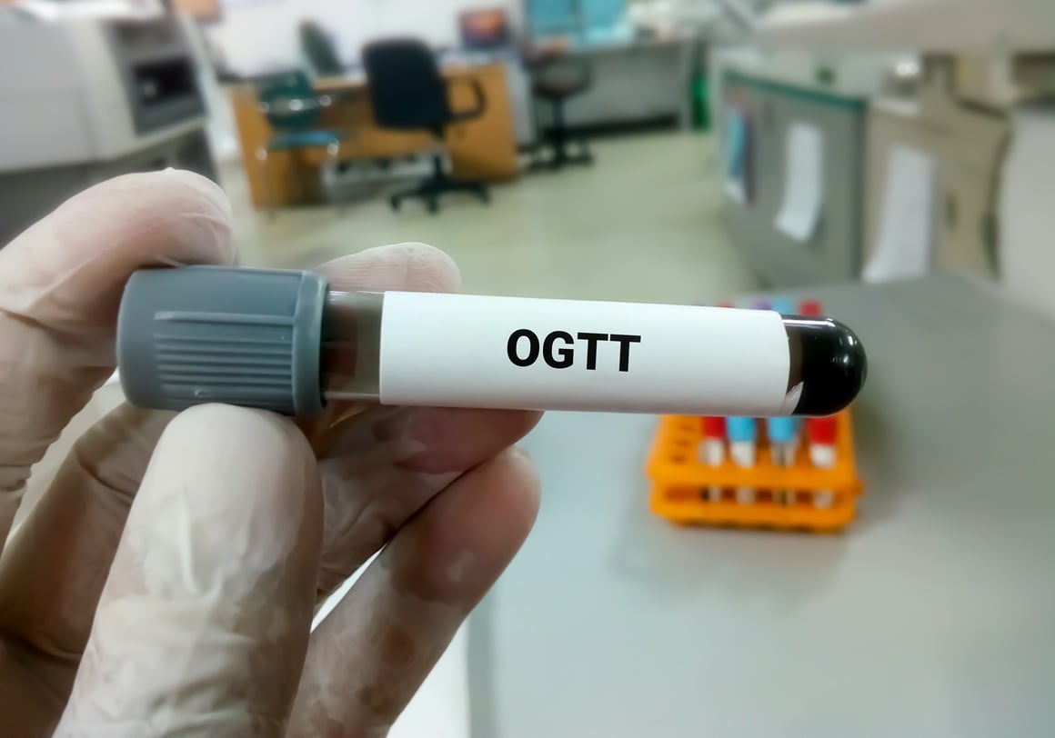 OGTT pretraga