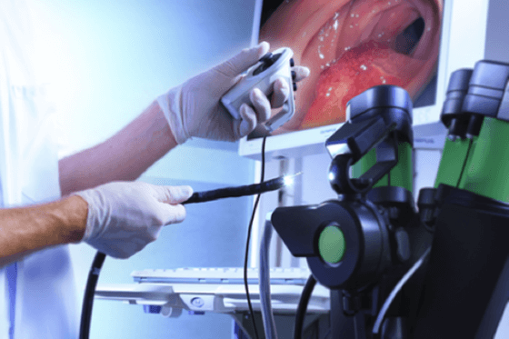 endoskopija-postupak