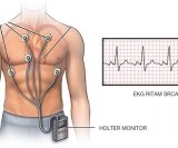 holter-ekg