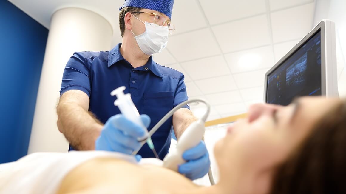 Citološka punkcija dojke