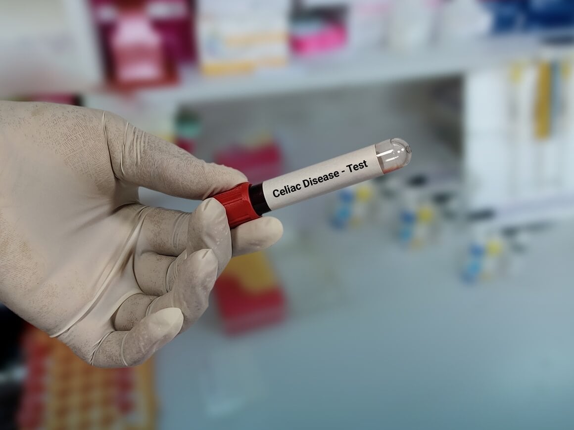 celijakija - test