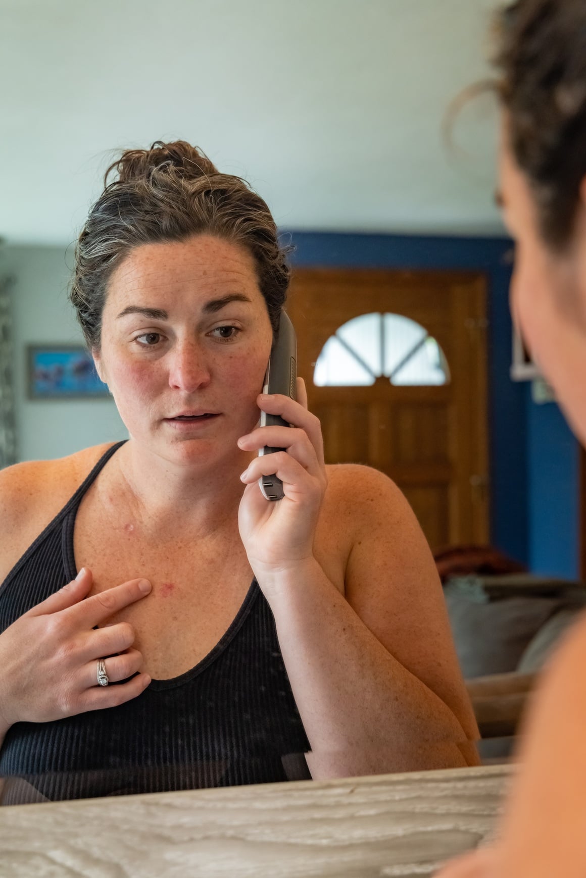 Bazocelularni karcinom - kontrola