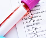 HbA1c