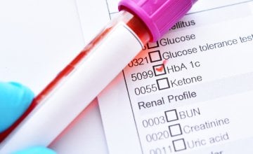 HbA1c