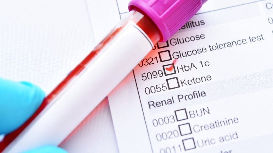 HbA1c