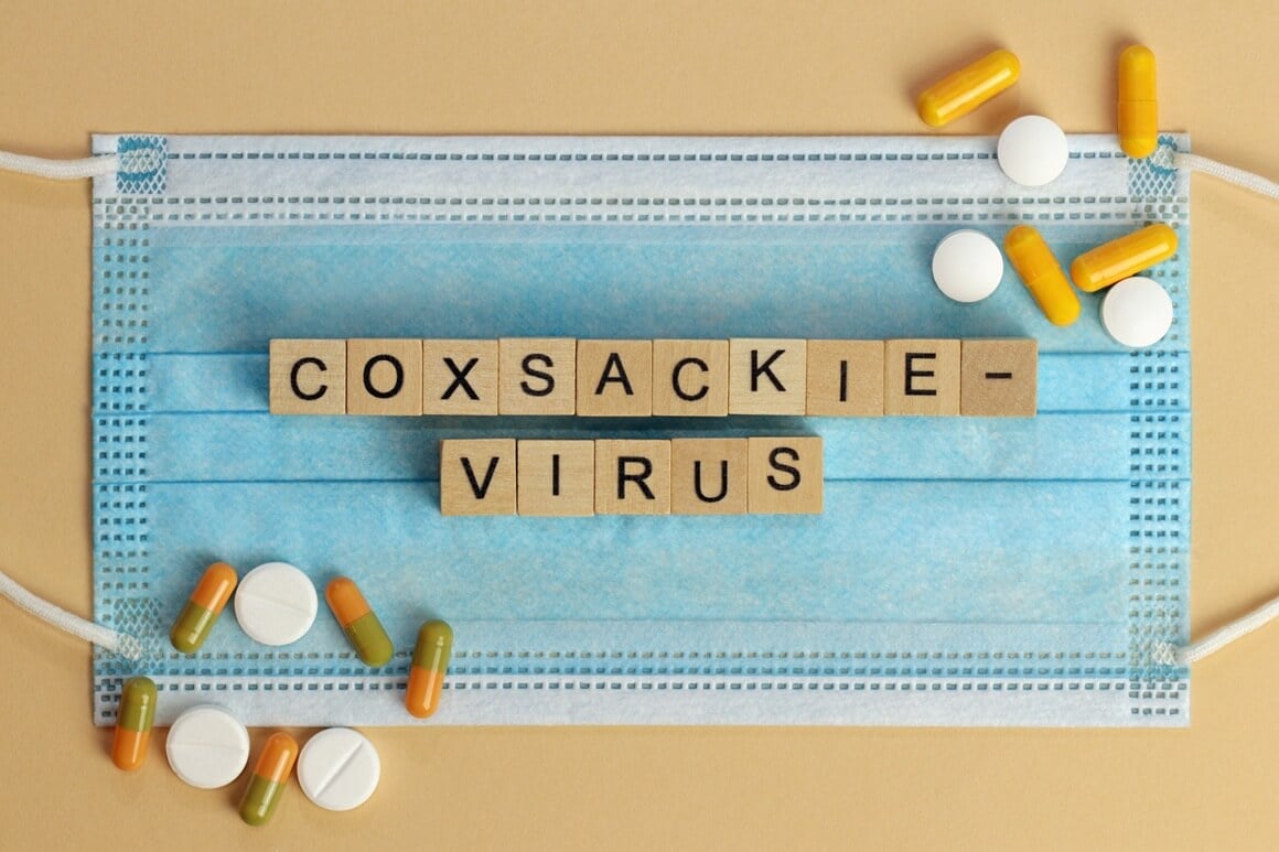Koksaki virus - liječenje