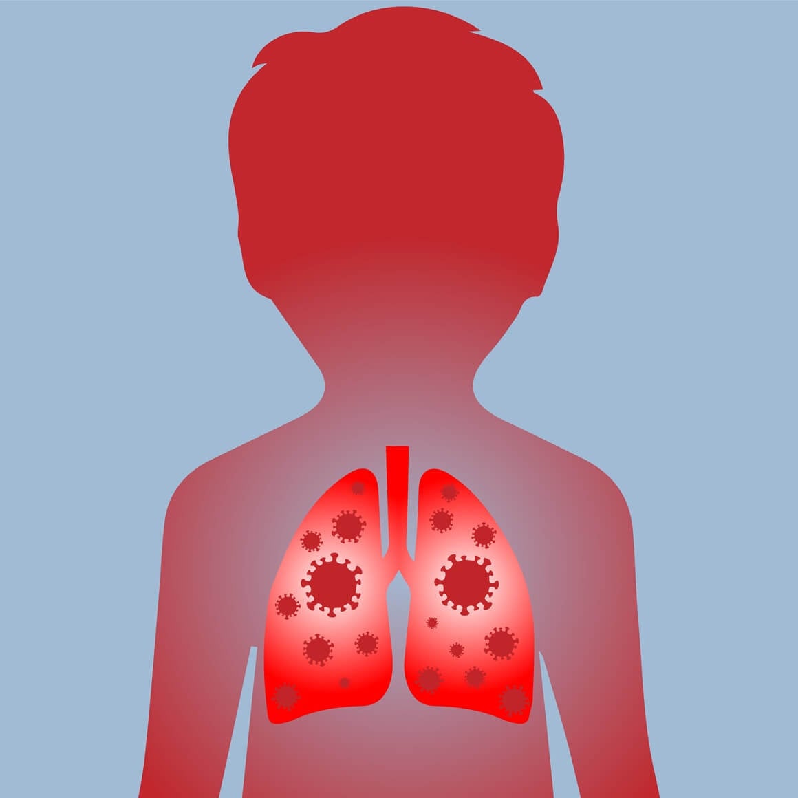 Upala pluća kod djece - uzrok