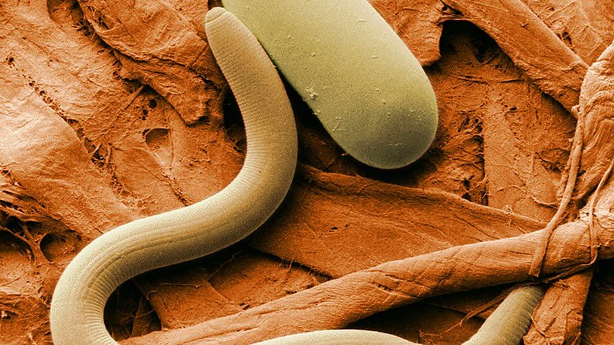 Paraziti kod djece simptomi Enterobiasis leitlinie
