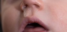Adenoviroza