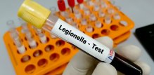 Legionarska bolest