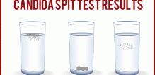 kucni-kandida-test