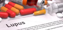 Liječenje lupusa