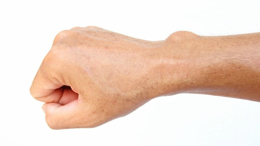 9 savjeta kako ublažiti bolove u zglobovima ruku i nogu