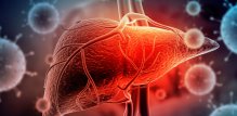 Hepatitis C