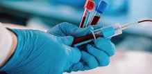 Hepatitis C - liječenje