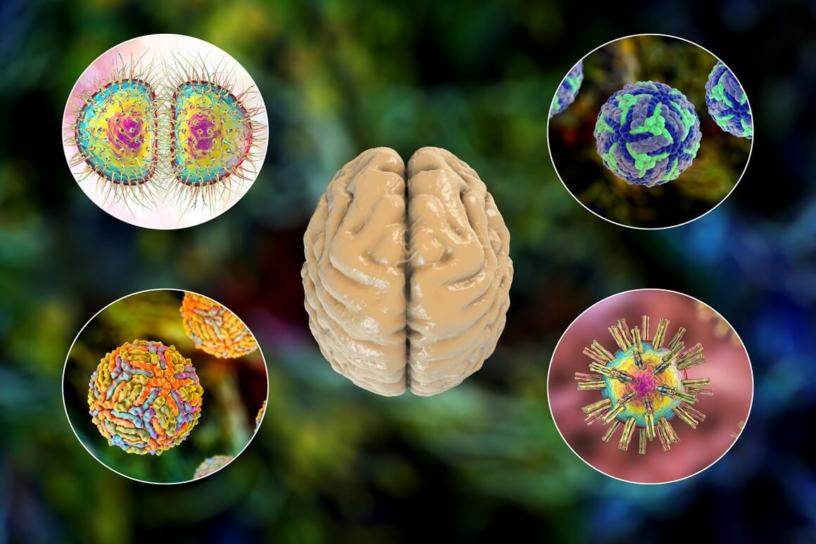 Je li meningitis zarazan